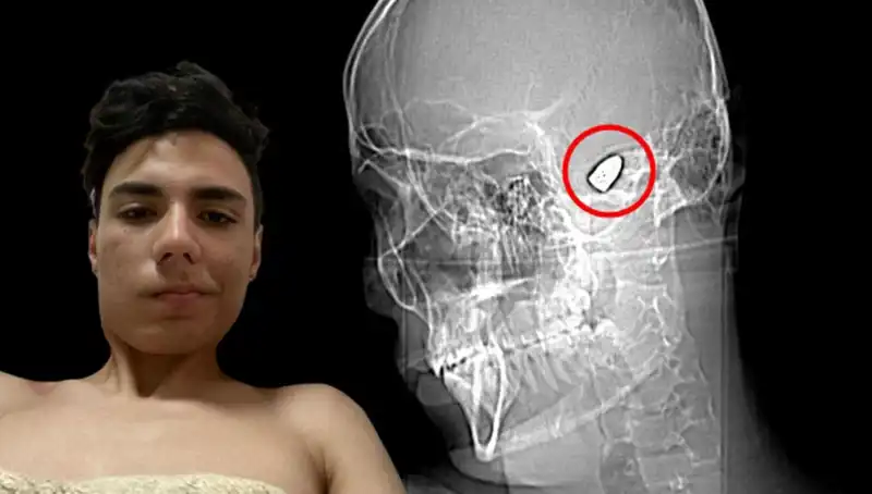 Kafasında Patlamaya Hazır Bomba: Psikolojik Etkileri ve Çözüm Yolları