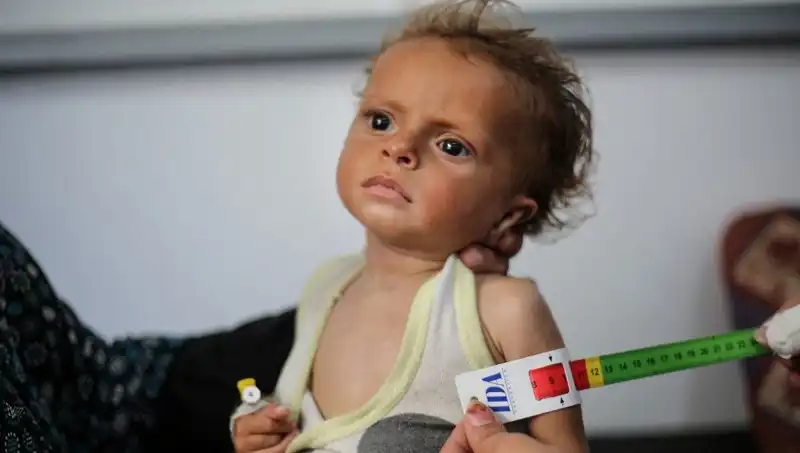 İngiltere, 300 Gazzeli Çocuğa Yeni Bir Gelecek Sunacak